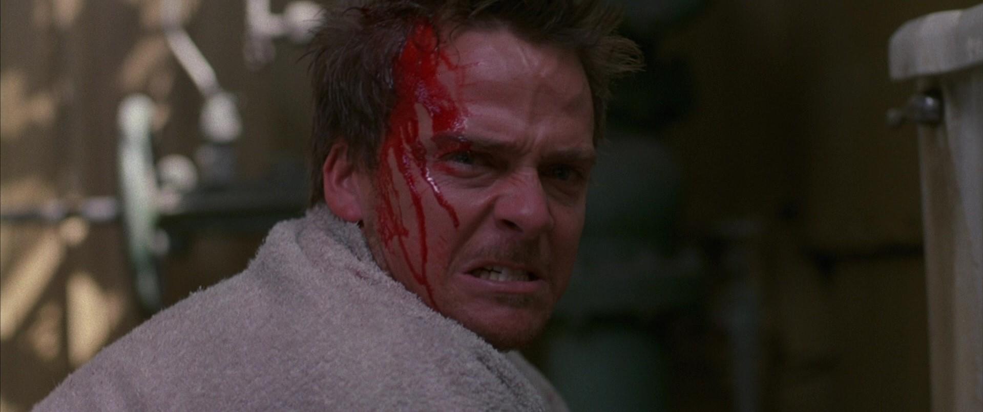 Flanery gets bloody