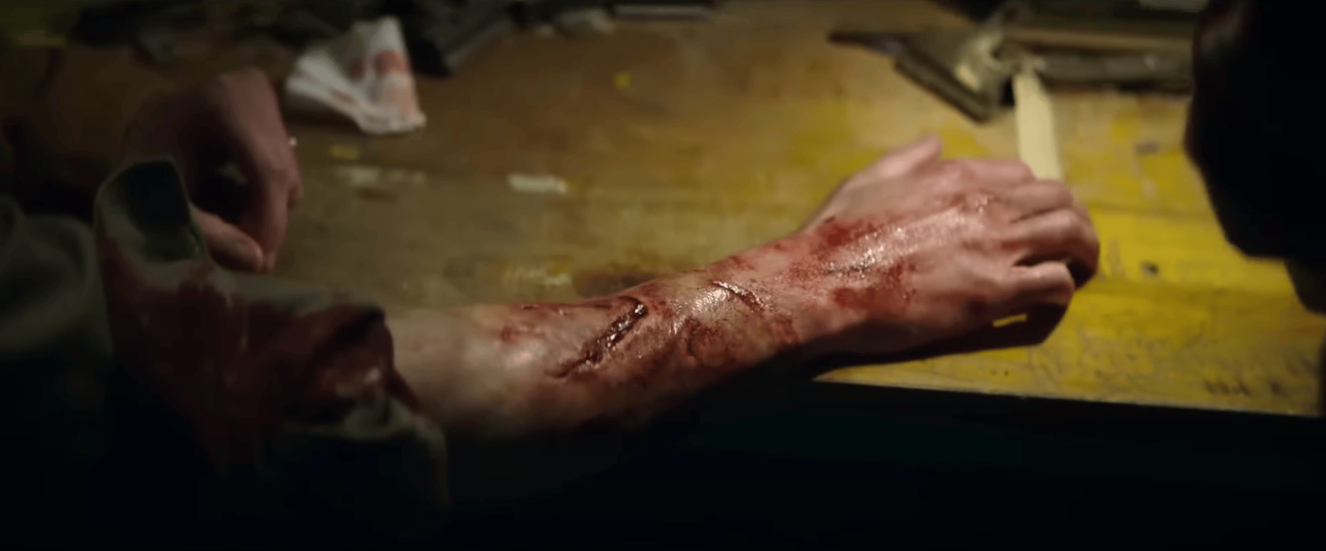 Scars