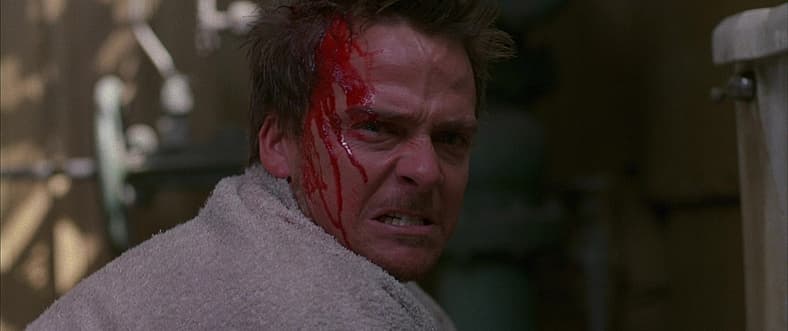 Flanery gets bloody