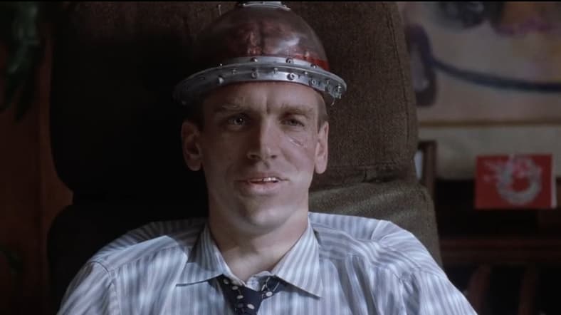 Hair transplant