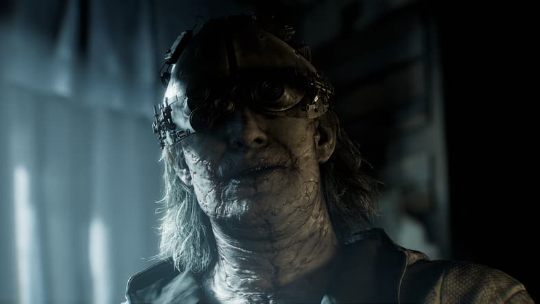 Victor Gideon (TBA) still suffers from the scarring effects of his burning in Resident Evil Requiem (2026), Capcom