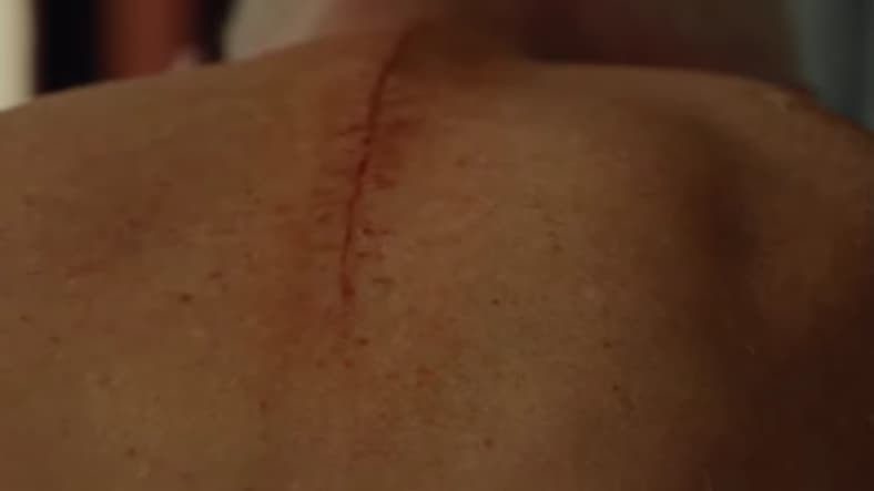 Scars to prove it