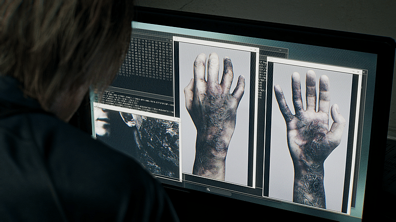 Leon (Toshiyuki Morikawa) looks at photos of an infection in a hand on a screen in Resident Evil Requiem (2026), Capcom