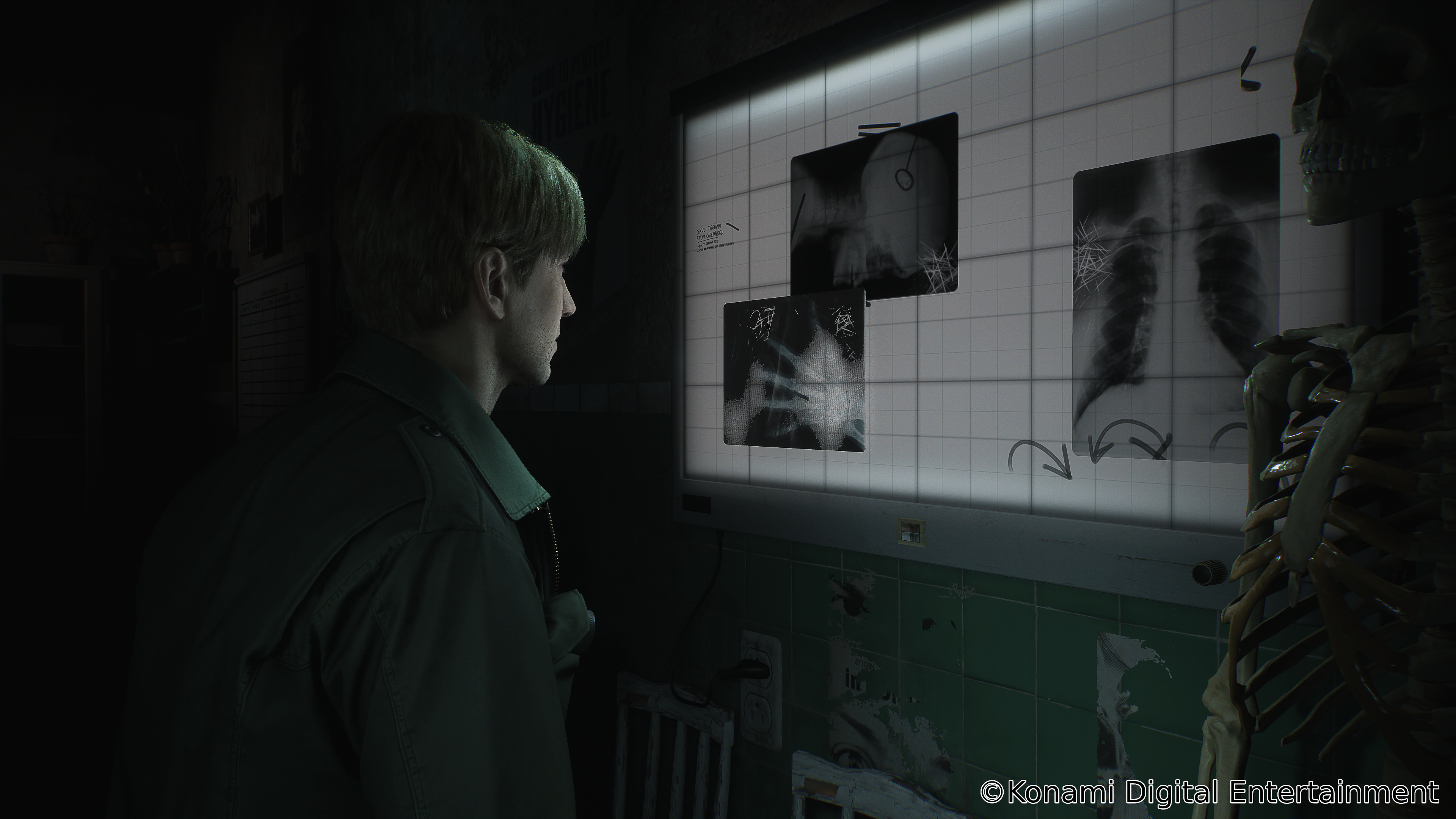 James Sunderland looks at x-ray scans via Silent Hill 2 (TBA), Konami