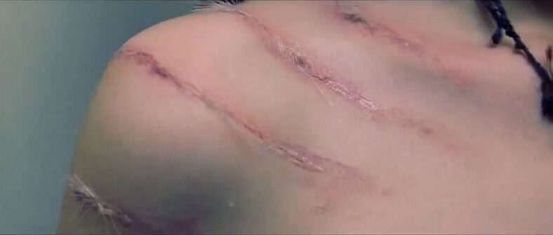 These wounds look a little infected in Ginger Snaps (2000), Motion International 